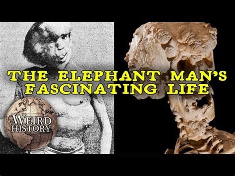 The Elephant Man Biography Story