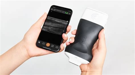 Clarius unveils the world's first ultra-high frequency handheld ultrasound scanner