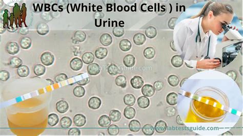 Wbc In Urine