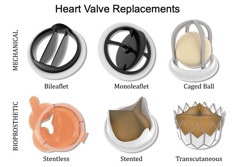 Heart valve anatomy, valve disease and heart valve replacement