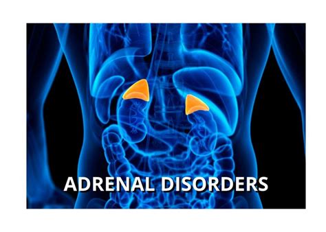 Adrenal Disorders | District Endocrine