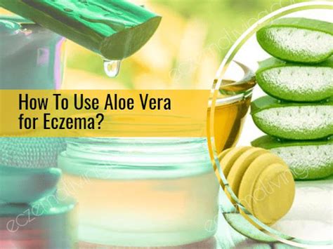 Aloe Vera for Eczema ☘️ 5 Proven Home Remedies & It's Benefits