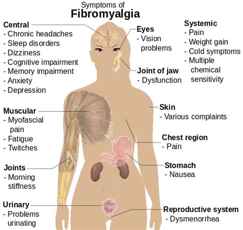 Myalgia | Current Health Advice, Health Blog Articles and Tips