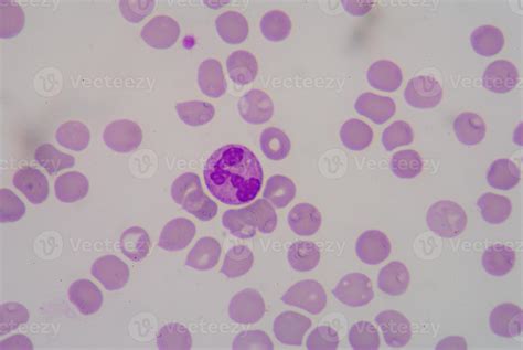 Red blood cells form microcytosis. 950941 Stock Photo at Vecteezy