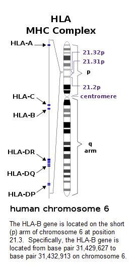 Ankylosing Spondylitis > HLA-B27