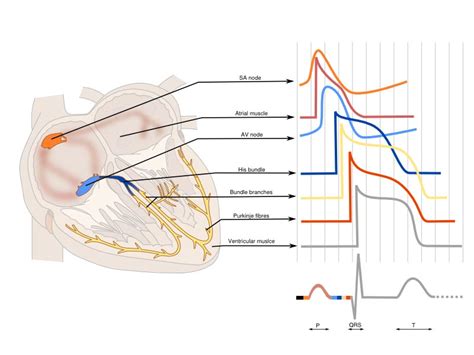 ECG (EKG) - bundle branch block - Oxford Medical Education