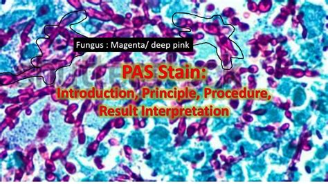 PAS Stain: Introduction, Principle, Procedure, Result Interpretation