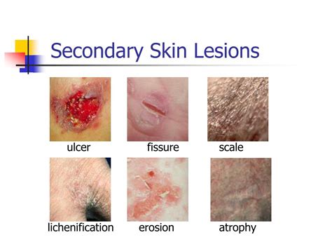 PPT - Non-Infectious Skin Diseases PowerPoint Presentation, free download - ID:210732