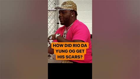 How Did Rio Da Yung Og Get His Scars? Pt 1 - YouTube