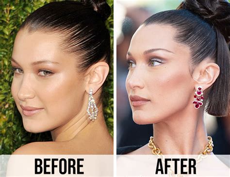 Bella Hadid Then & Now: See How Much Her Face Has Changed Over The ...