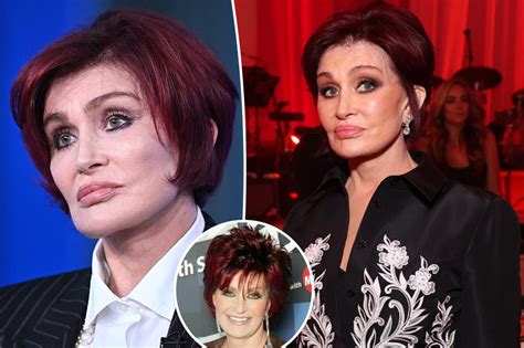 Sharon Osbourne done with plastic surgery after facelift gone wrong