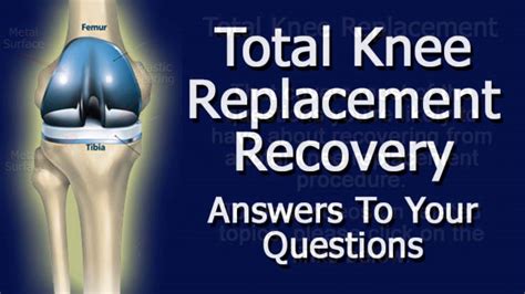 total knee replacement exercises advanced - simich-scarboro99