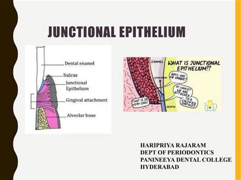 Clinical significance of junctional epithelium