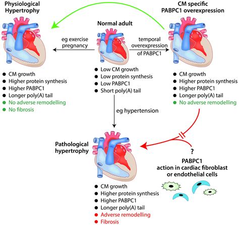 Cardiac Hypertrophy And Heart Failure