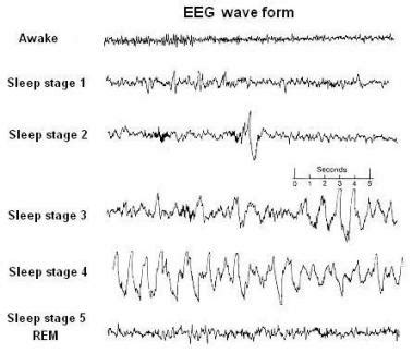 Sleep And The Brain