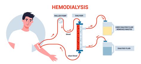 AFM Technology improves equipment for dialysis patients