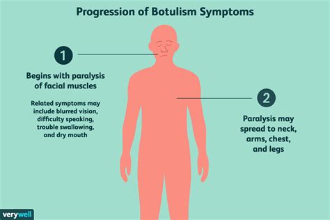 Botulism