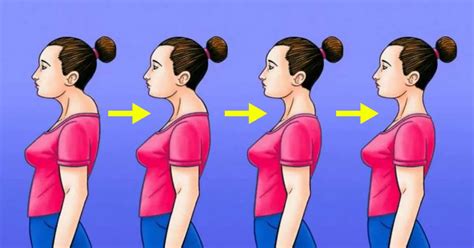 4 Neck Hump Exercises That will improve Posture