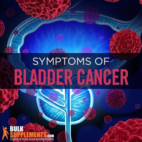 Tablo | Read 'Bladder Cancer: Symptoms, Causes & Treatment' by