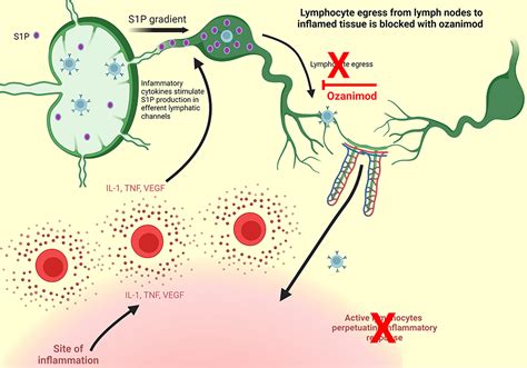 Ozanimod Therapy in Inflammatory Bowel Disease | TCRM