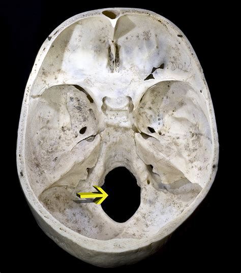 ファイル:Crane4 Foramen magnum.png - Wikipedia