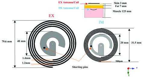 Coil and antenna configuration for the external antenna/coil ...