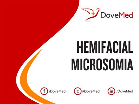 Hemifacial Microsomia