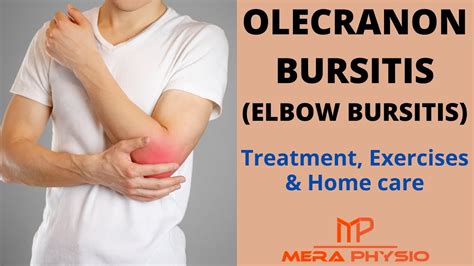 Olecranon Bursitis (Elbow Bursitis) | Treatment, Exercises & Home Care ...