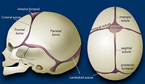 Sagittal Suture Craniosynostosis