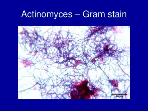 Actinomyces