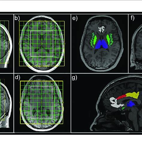 | Magnetic resonance spectroscopic imaging (MRSI) position and mask... | Download Scientific Diagram