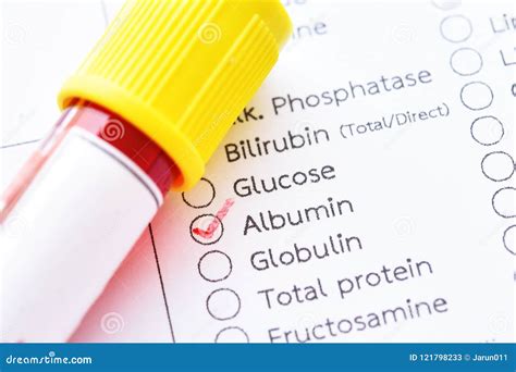 Blood Sample Tube for Albumin Protein Test Stock Image - Image of ...