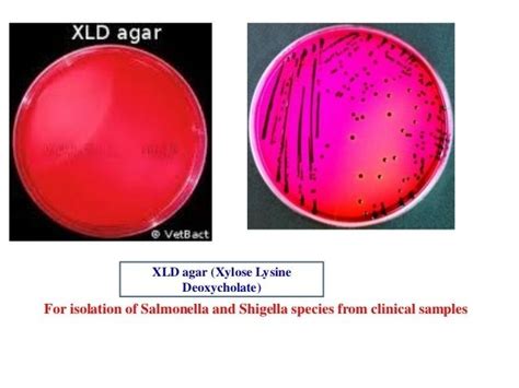 XLD agar - Alchetron, The Free Social Encyclopedia