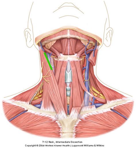 Clinical Cases - Carotid Endarterectomy