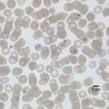 Pathogenic Protists | Biology for Majors II