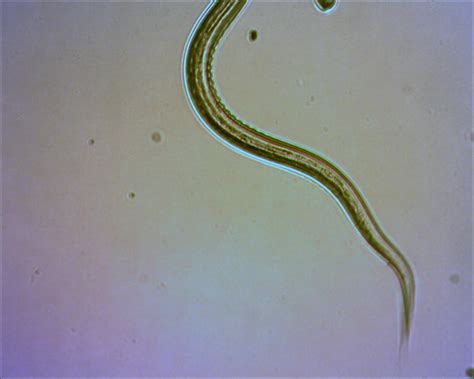 New partnership takes on hookworm infection in rural Alabama | BCM