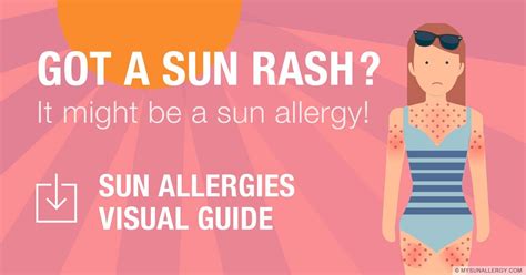 Sun Rash Visual Guide - My Sun Allergy