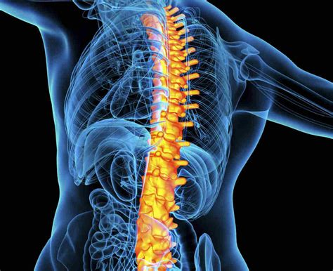 Types Of Spinal Fractures Radiology - Design Talk