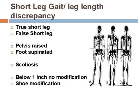 ABNORMAL GAIT Abnormal Gait Syndromes In general gait