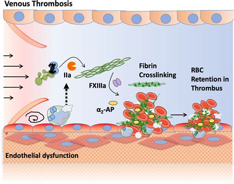 Fibrinogen and Factor XIII in Venous Thrombosis and Thrombus Stability | Arteriosclerosis ...