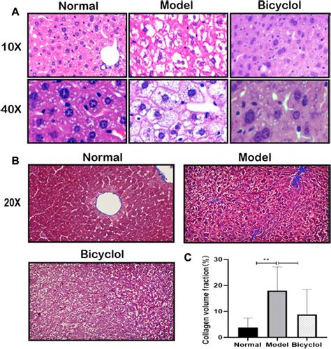 Frontiers | Bicyclol attenuates high fat diet-induced non-alcoholic ...