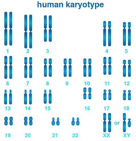 Karyotype, karyotype test & analysis, normal karyotype & abnormal karyotype