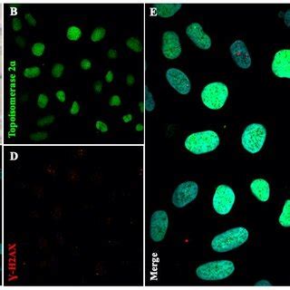 Microscopy images of simultaneous trypan blue and IF staining of U2OS ...