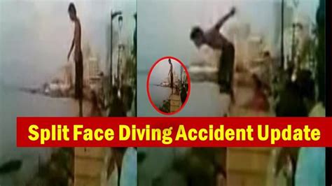 Split Face Diving Accident Video | Face Split Diving Accident Video Twitter and Reddit Goes ...