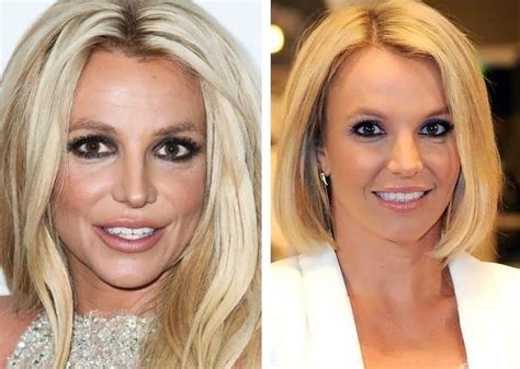 Britney Spears Before and After Cosmetic Surgery - Verge Campus