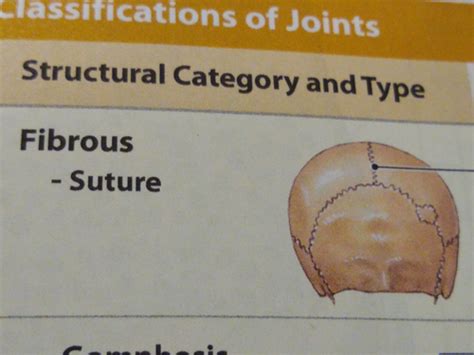 Visual A&P 1 - CH. 8 ️ JOINTS Flashcards | Quizlet