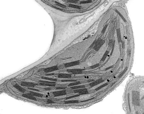 Chloroplast Micrograph