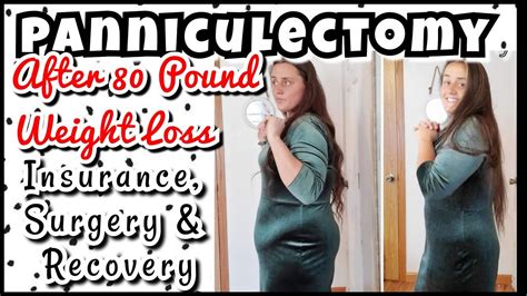 Panniculectomy: My Story - Insurance, Surgery & Recovery - YouTube