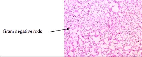 Gram-staining of Salmonella isolates. | Download Scientific Diagram