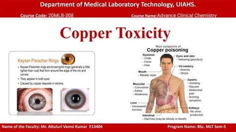 Copper toxicity.pdf